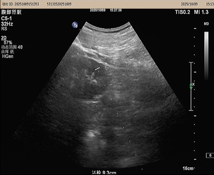 1762481934850187.png image.png