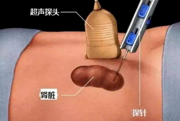 1762481984286303.png image.png