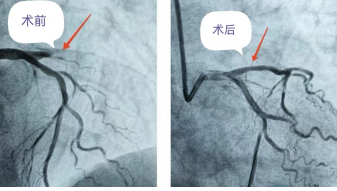 1768900461203739.png 82c2ac2b36631f16ae22d285bdd8cac8.png