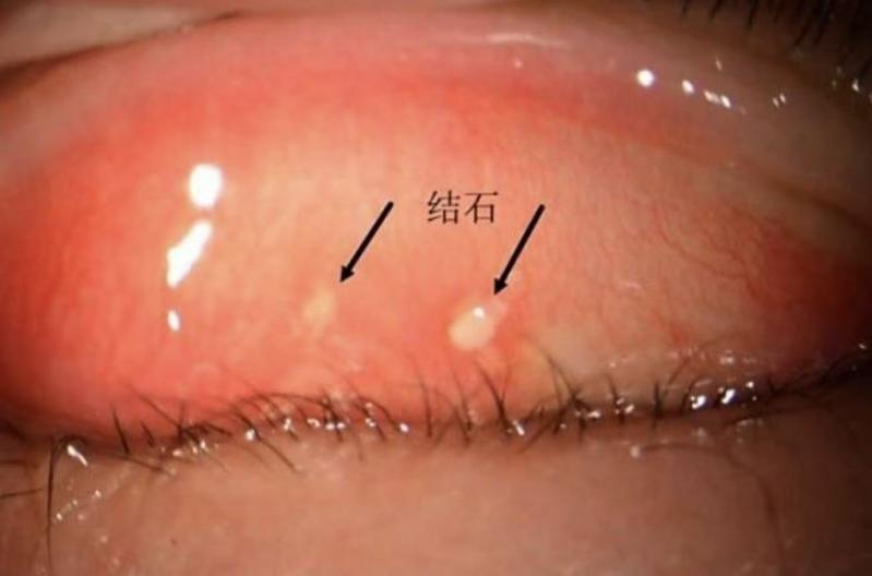 1768959762298919.png 2adccabe94af988902ceda65cd05e87d.png