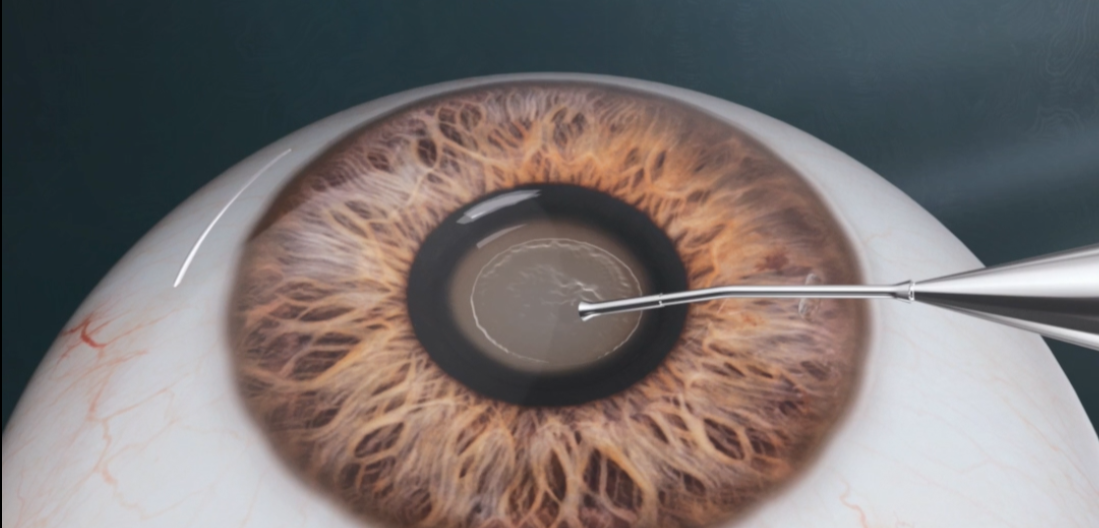 1774253708122455.png 093dd4d045ed69a5583a0ee77dee59eb.png